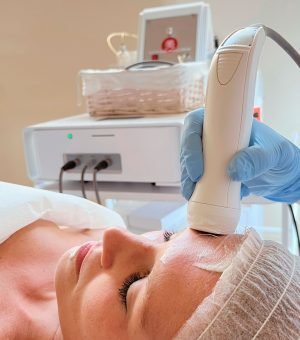 Tratamiento con Punta de Diamante | Exfoliación Profunda y Renovación