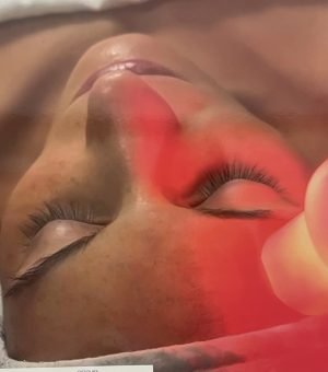 Meso Skin Dual | Mesoterapia Avanzada para Rejuvenecimiento Facial y Corporal